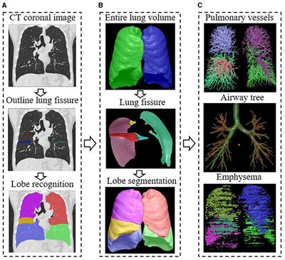 Potential Value of Expiratory CT in Quantitative Assessment of Pulmonary Vessels in COPD